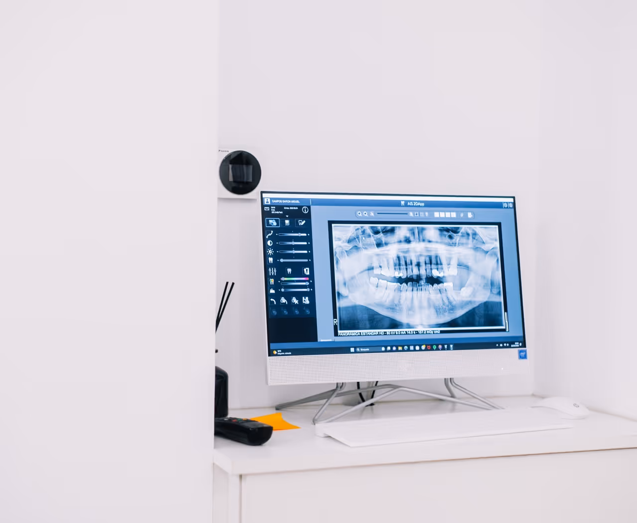 MiD intraoral scanning