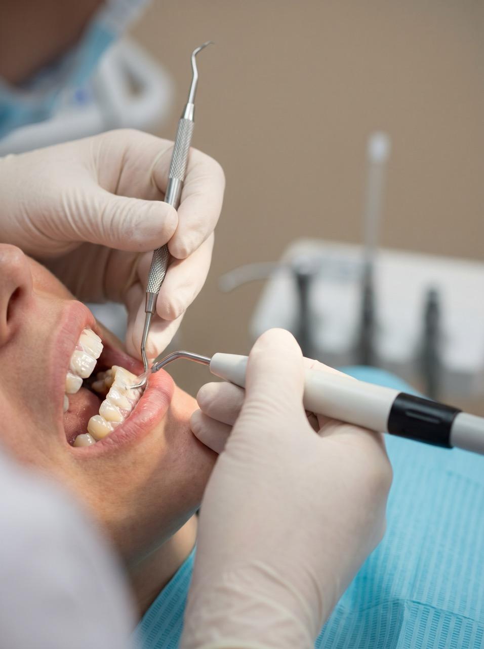 Higiene Dental